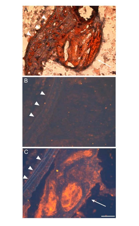 ApoD is localized to atherosclerotic plaques ofapoE?deficient mice