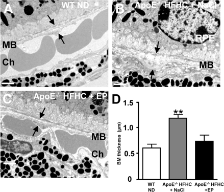 CD36 stimulation reduces BM thickness in high cholesterol fed ApoE −/− mice