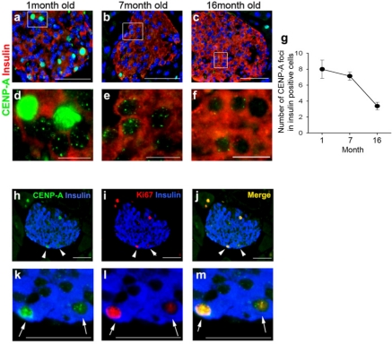 CENP-A expression in mouse beta-cells as a function of age