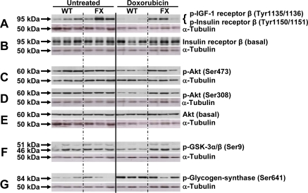 Activation of mitochondrial metabolism sustains activation of the insulin signaling cascade following doxorubicin-induced cardiomyopathy