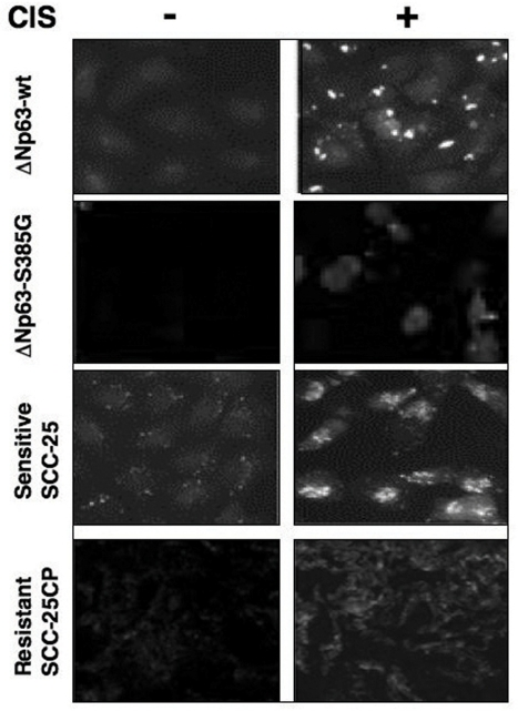 Immunofluorescence staining of LC3B expression in squamous carcinoma cells upon cisplatin exposure