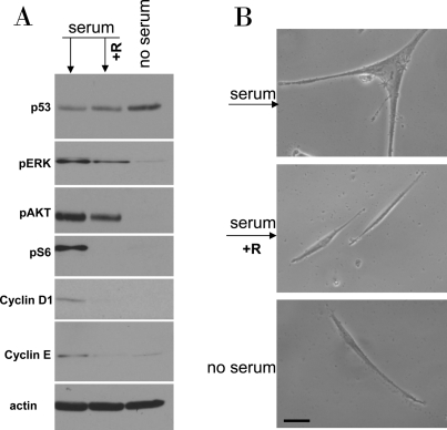 Serum stimulation of etoposide-locked WI-38t cells results in mTOR-dependent sensecence