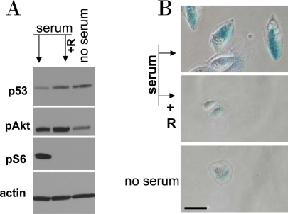 Serum stimulation of etoposide-locked RPE cells results in mTOR-dependent senescence