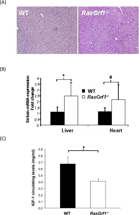 Metabolic Analysis of RasGrf1−/− Mice