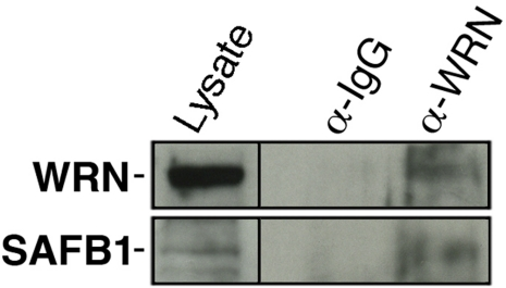 Co-immunoprecipitation of SAFB1 with the WRN protein in HEK 293 cells. Immunoprecipitation was performed with an antibody against the WRN protein. The immuno-precipitate was analyzed by western blot analyses with an antibody against SAFB1. The lysate represents 10% of total proteins in the immunoprecipitation reaction.