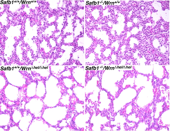 Hematoxilin and eosin staining of lung tissues from 19 days old embryos from the indicated genotypes. Magnification 400X.