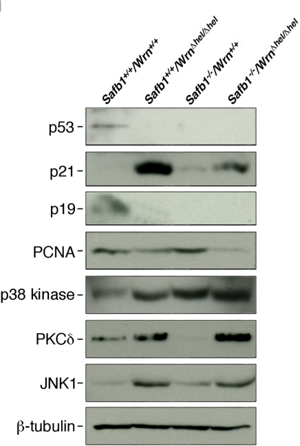 Protein levels of p53, p21Waf1, p19Arf, PCNA, p38 kinase, PKCδ, and JNK1 in MEFs. Whole cell lysates from MEFs of each genotype were analyzed by immunoblotting with antibodies against the indicated proteins. Proteins were extracted from wild type, WrnΔhel/Δhel, Safb1-null, and Safb1-null/WrnΔhel/Δhel MEFs. β-tubulin was used as a loading control.