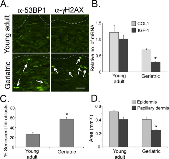 Senescent fibroblasts accumulate in geriatric dermis in vivo