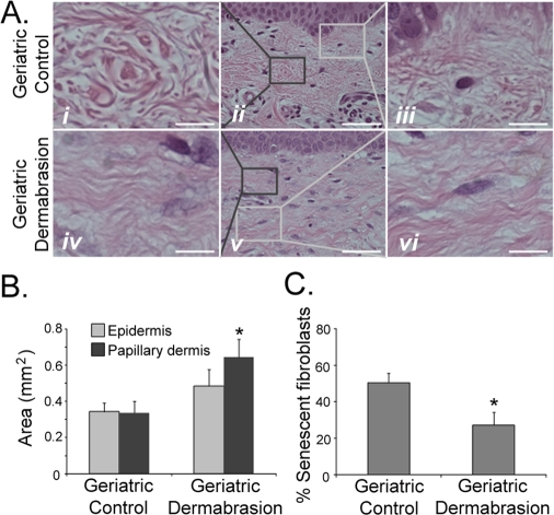 Dermabrasion restores young adult fibroblast function in geriatric dermis