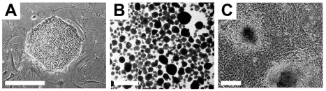 Typical undifferentiated and differentiating hESCs in culture