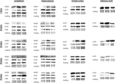 DNA repair in the brain tissues of young, adolescent and adult animals