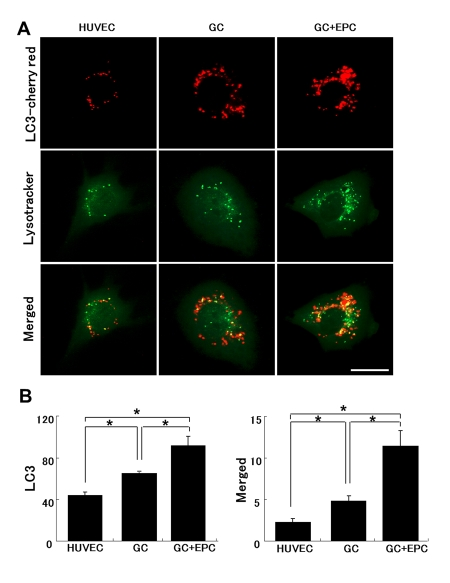 Lysosomal and autophagosomal punctae in control or stressed (GC) HUVEC