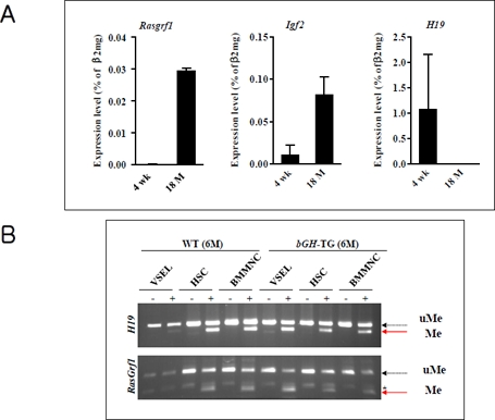 The change of genomic imprinting during VSEL ageing