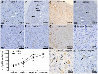 Induction of double strand DNA breaks in human primordial follicles by doxorubicin