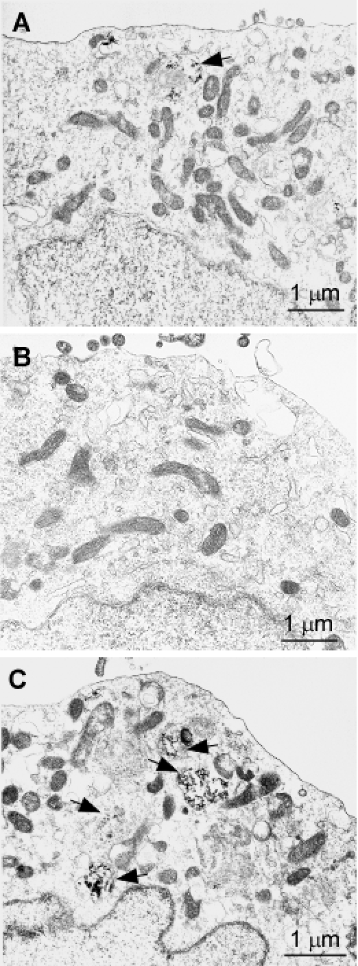 Digestion of wild-type and mutant PrP by Endo H