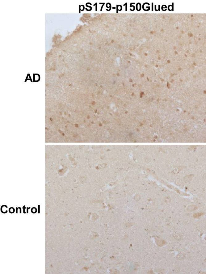 An increased phosphorylation level of p150Glued in AD neurons