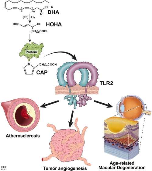 Key pathological effects of lipid oxidation products related to the aging