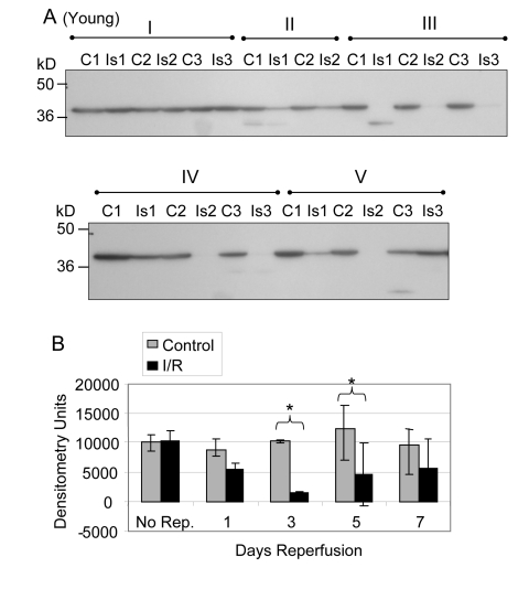 GAPDH pool levels in plantaris/FHL lysate from young mice