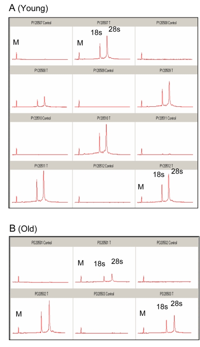 Analysis of total RNA from control and ischemic plantaris muscle following 5 days of reper-fusion