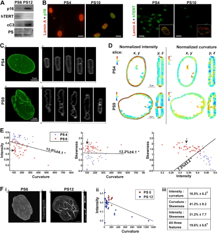 Quantification of nuclear lamina structure changes in senescent cells