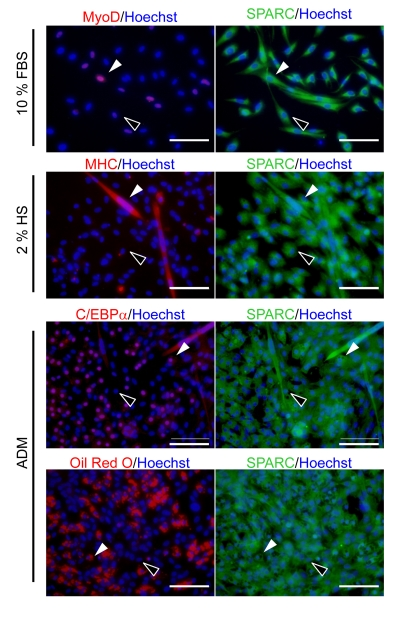 Immunocytochemistry of SPARC in SMPCs