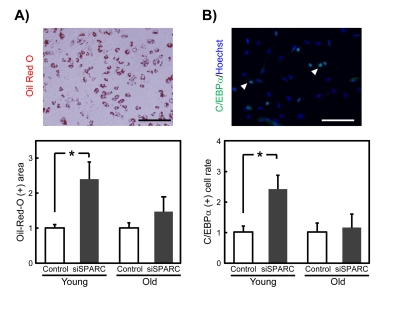 Effects of siSPARC on the adipogenic potential of SMPCs