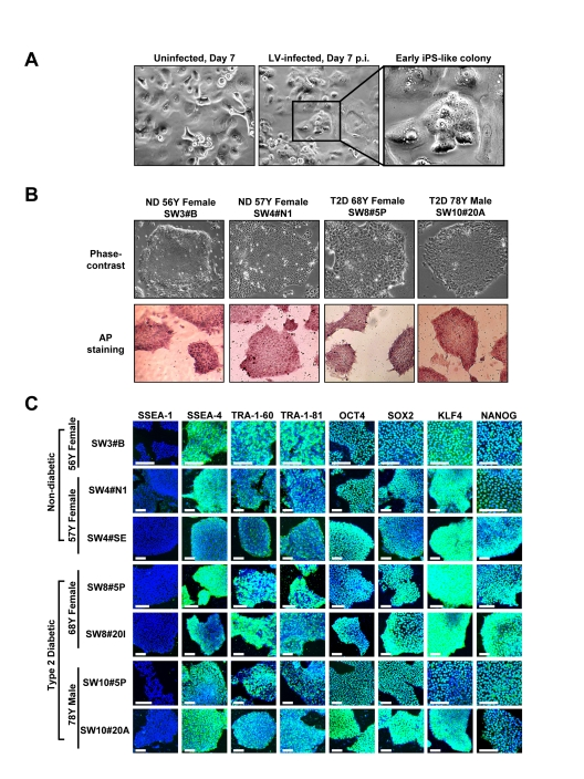 Expression of pluripotency-associated markers in HK-derived iPS clones