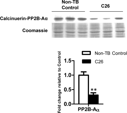 Protein expression of calcineurin