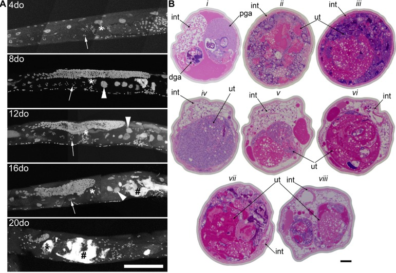 Germline masses accumulate with age