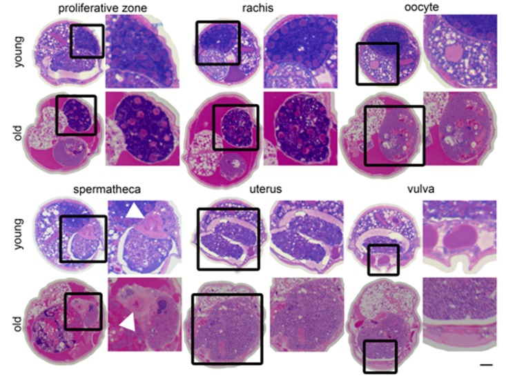 Changes in the germline with age