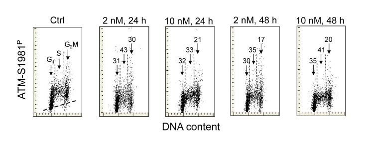 Effect of treatment of A549 cells with 1,25-VD on the level of expression of ATM phosphorylated on Ser1981 in relation to the cell cycle phase