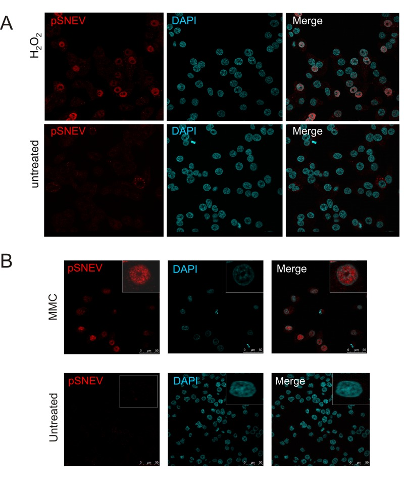 Upon oxidative stress, SNEV is phosphorylated and localizes mainly to the nucleus