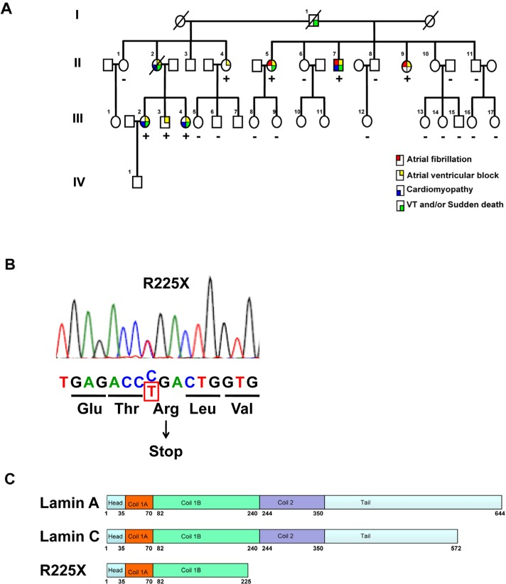 Clinical phenotype and LMNA genotype(A) The pedigree of the proband (Patient II-7) with cardiac laminopathy featuring atrial fibrillation, atrioventricular block, dilated cardiomyopathy, ventricular tachyarrhythmia and sudden cardiac death. Four-generation family had 9 affected members showing autosomal-dominant cardiac disease. (See also table 1)(Square = male; circle = female; slash = deceased). A nonsense LMNA mutation (R225X) segregates with atrial fibrillation, atrioventricular block, dilated cardiomyopathy and ventricular tachyarrhythmia (“+” = LMNAR225X/WT, “-” = LMNAWT/WT). (B) The sequence chromatogram of the mutant allele of LMNA. The mutation altering amino acid sequence (in red) predicts a premature stop codon. (C) The schematic of lamin A/C proteins. Alternative splicing results at 572 and 664 amino acid lamin C and lamin A proteins. The R225X mutation results in a premature stop codon in the α-helical rod domain, thus a truncated lamin protein.