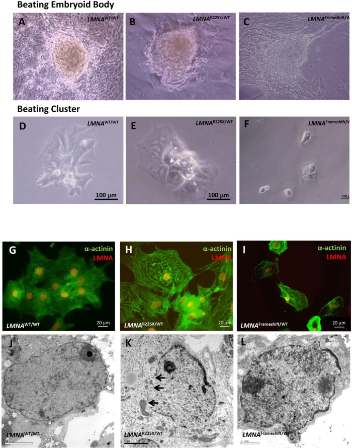 Cardiomyocytes derived from LMNAR225X/WT, LMNAFrameshift/WT and LMNAWT/WT iPSCs