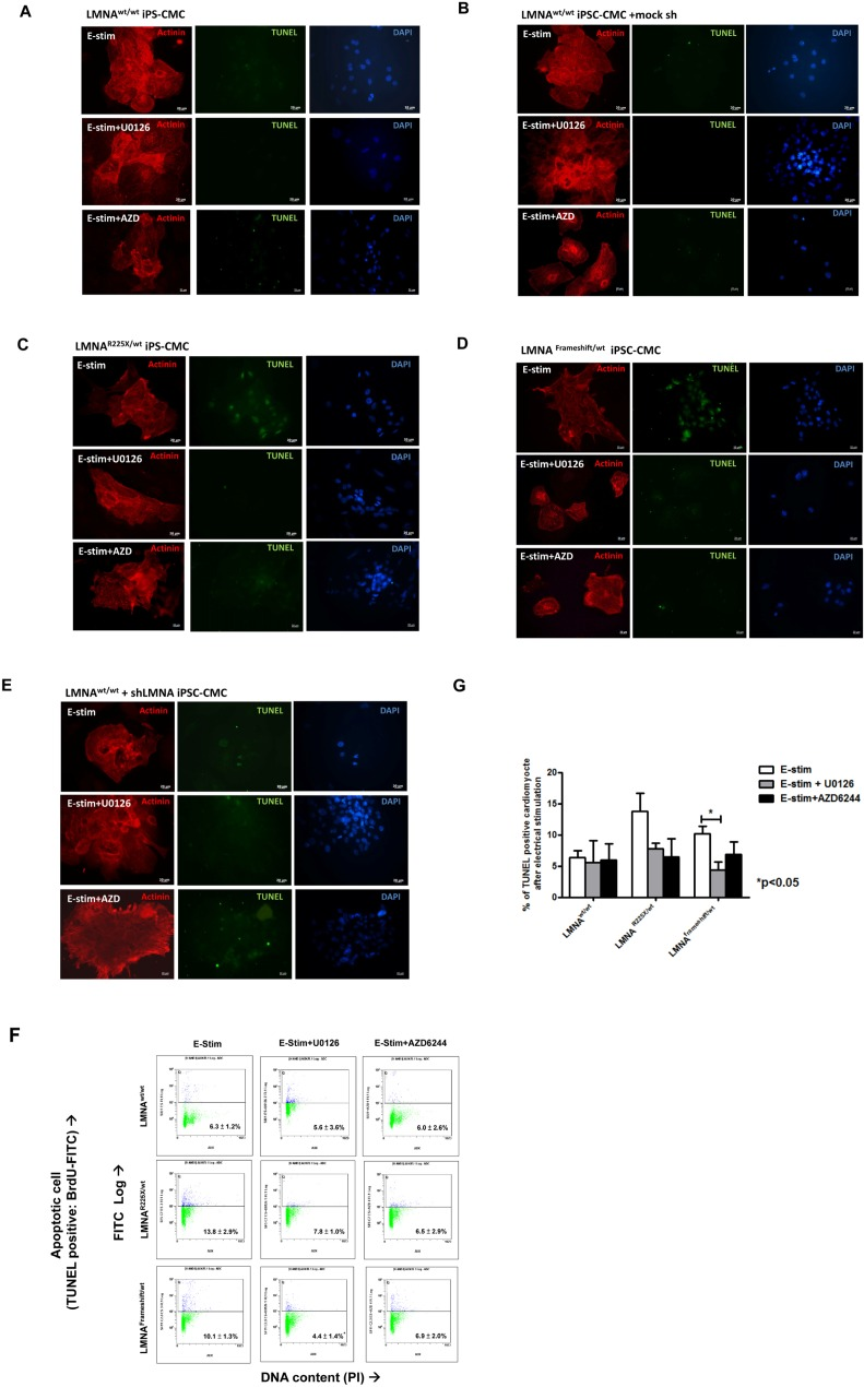 Electrical stimulation inducing apoptosis in cardiomyocytes derived from LMNAR225X/WT &LMNAFrameshift/WT iPSCs