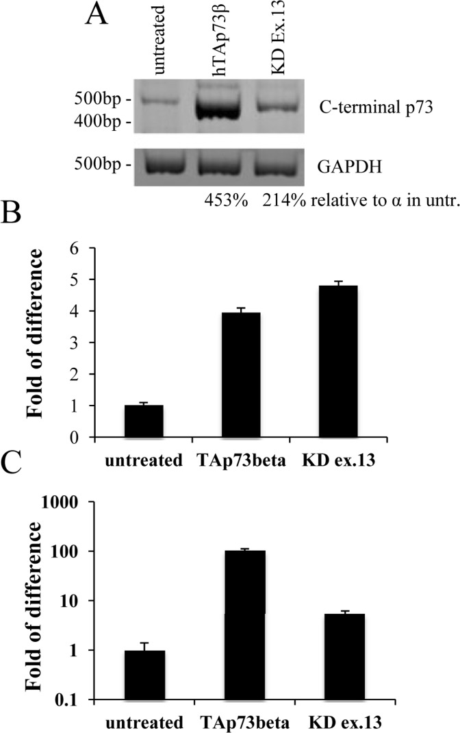 Tyrosine hydroxylase levels correlates with p73 transactivation potential