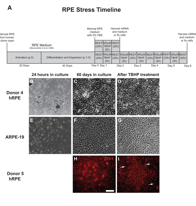 RPE cell morphology is disrupted by chronic TBHP treatment