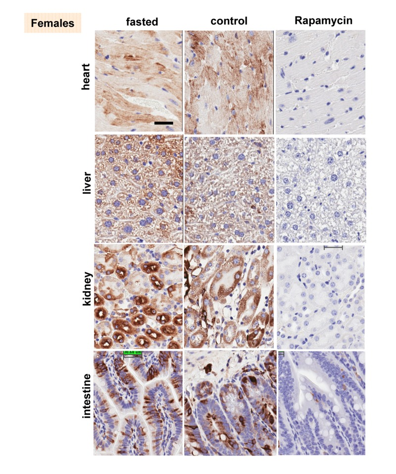 Females: Immunochemistry of pS6 in the organs