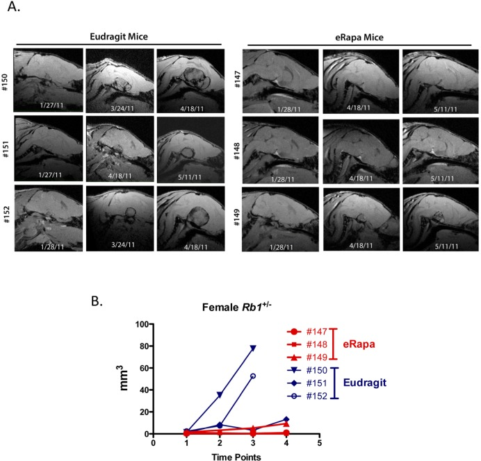 Effects of eRapa on pituitary and thyroid tumor development and growth. To identify effects on tumors, we used MRI as a non-invasive method to longitudinally monitor individual Rb+/− mice. High-resolution images were obtained on a very high field strength Bruker Pharmascan 7.0T animal MRI scanner using a coil to focus on pituitary and thyroid tumors. Images were acquired using a spoiled gradient echo named Fast low angle shot MRI (FLASH) on the scanner. Images were acquired to yield predominantly T1 weighted contrast with TE (echo time) 4.5 msec, TR (repetition time) 450 msec, FA (Flip angle) 40 degrees, FOV (field of view) 20 x 20 mm, in plane spatial resolution 0.078 x 0.078 mm. Tumor volume was determined for each time point. (A) Serially acquired MRI images from eRapa and Eudragit-fed control mice at 9, 11 and 12 months of age. (B) Tumor volumes calculated from MRI image stacks at each time point comparing individual mice at multiple ages. Tumors in two of the Eudragit-fed (control) mice are detected earlier and grow faster than the 3 eRapa-fed mice.