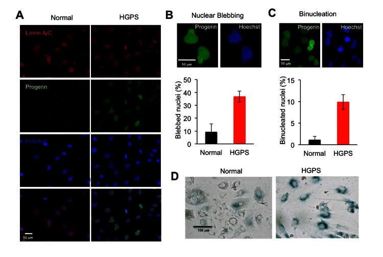 HGPS adipocytes exhibit characteristic cellular phenotypes