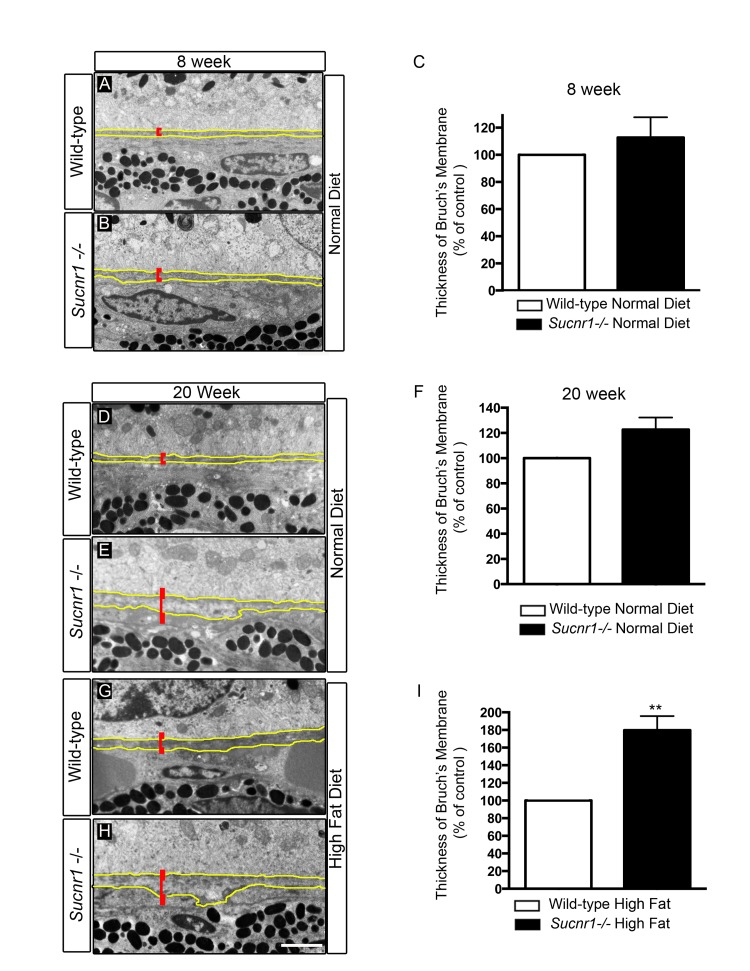 Sucnr1−/− mice develop Bruch's membrane thickening