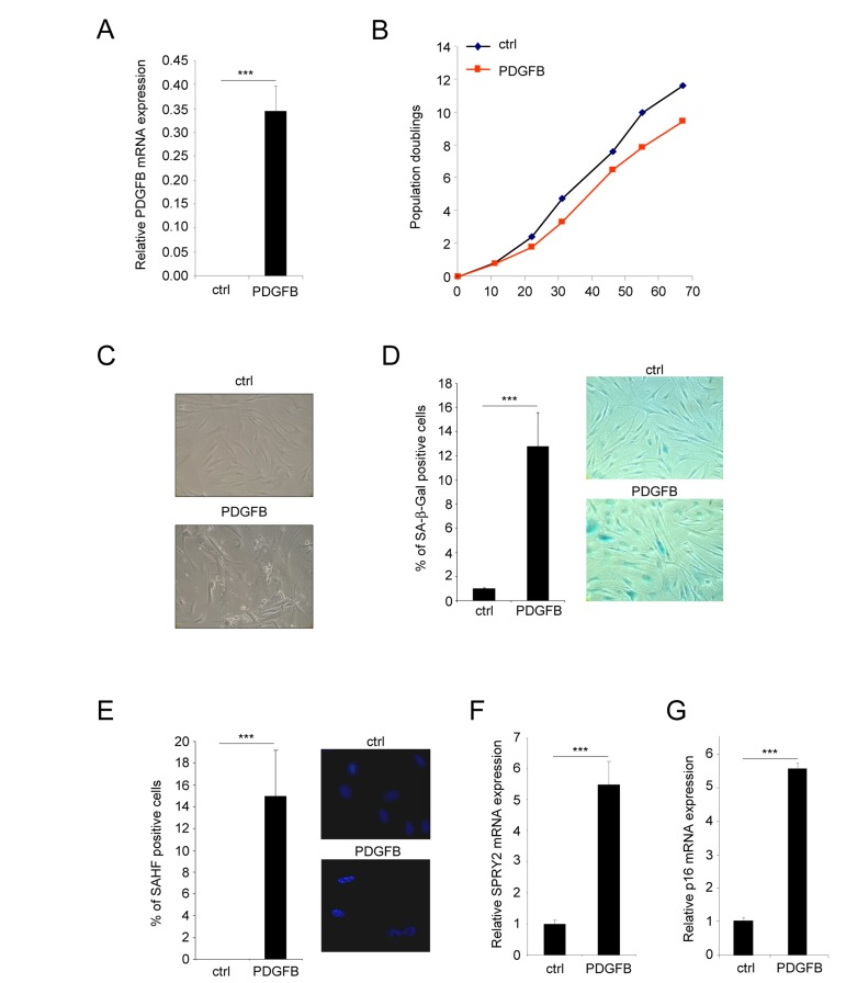 PDGFB induces cellular senescence