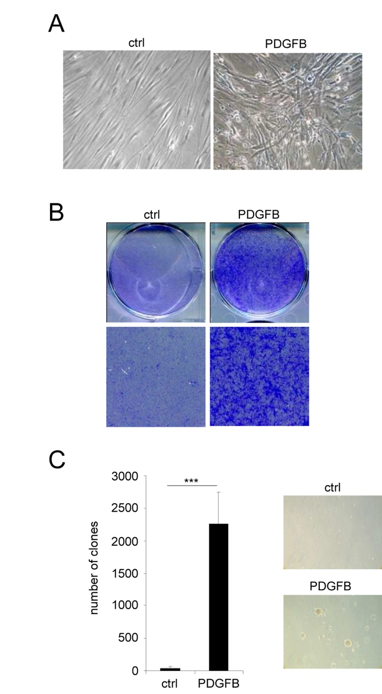 PDGFB induces cellular transformation