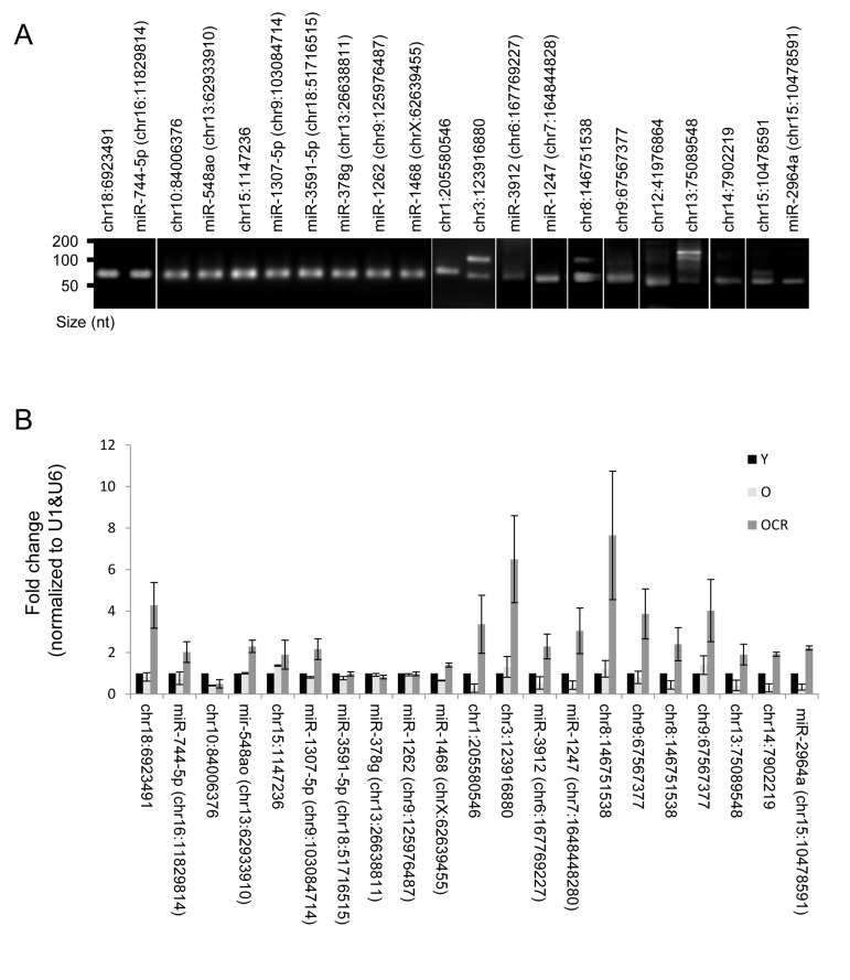 Novel miRNAs and impact of CR