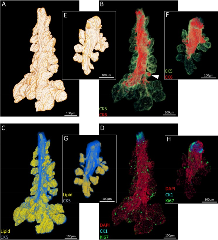 Segmented ICT reconstructions of (A-D) a 5month and (E-H) 2 year old mouse meibomian gland. In older meibomian glands, there is a notable loss of acini (A:E), ductal epithelium (B:F), lipid volume (C:G) and total cell number (D:H).