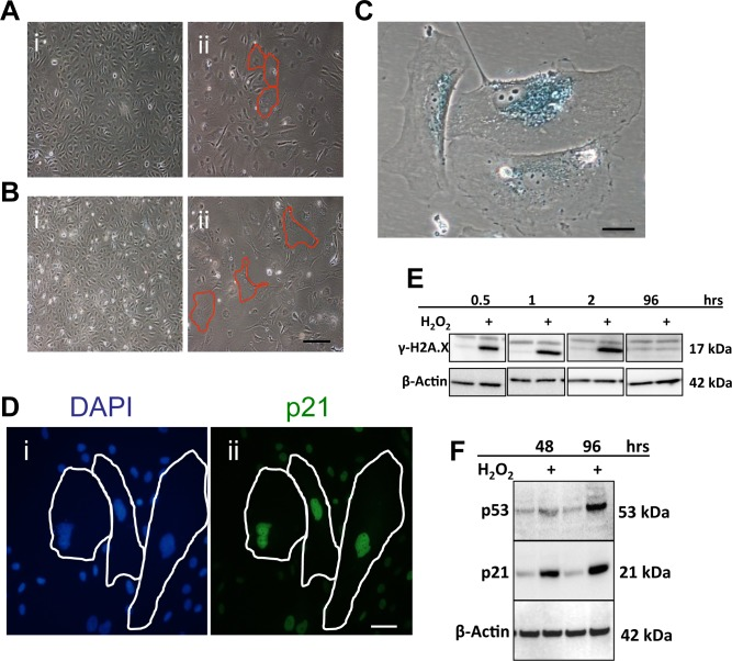 Oxidative stress induces senescence in ECs