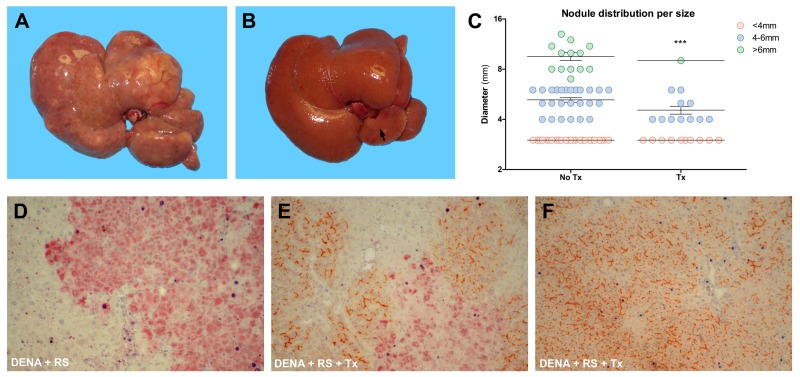 Analysis of liver lesions