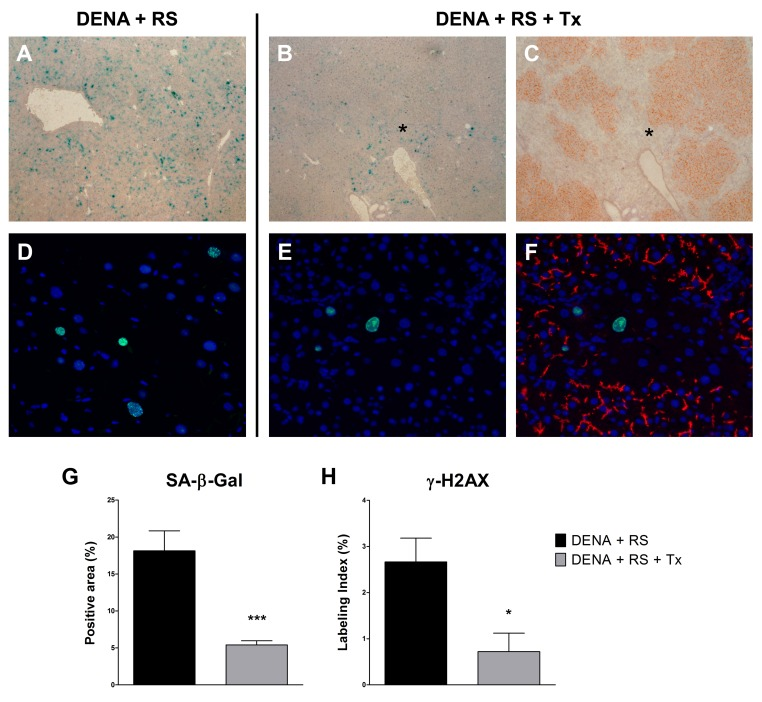 Hepatocyte transplantation reverses the RS-induced senescent phenotype