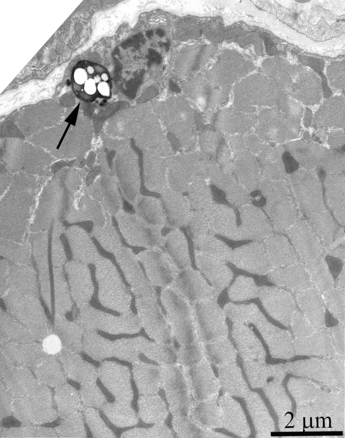 Cross-section of the muscle fiber from a 24-month-old Wistar rat. The arrow indicate autophagosome.