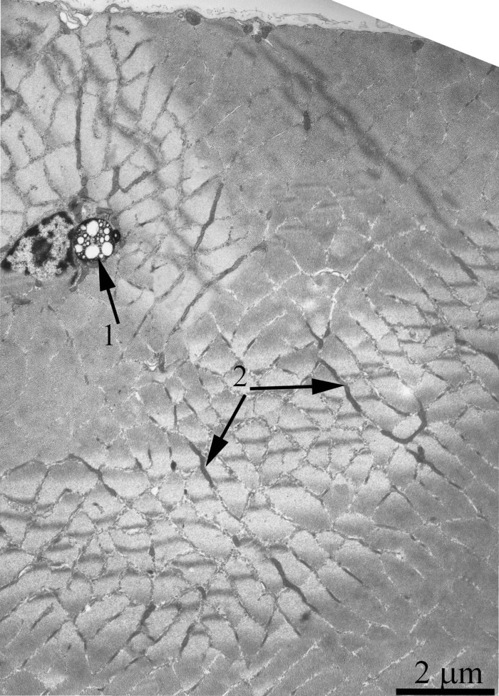 Cross-section of the muscle fiber from a 24-month-old OXYS rat. The arrows indicate: autophagosome (1) and small elongated mitochondrial profiles in the isotropic region (2).